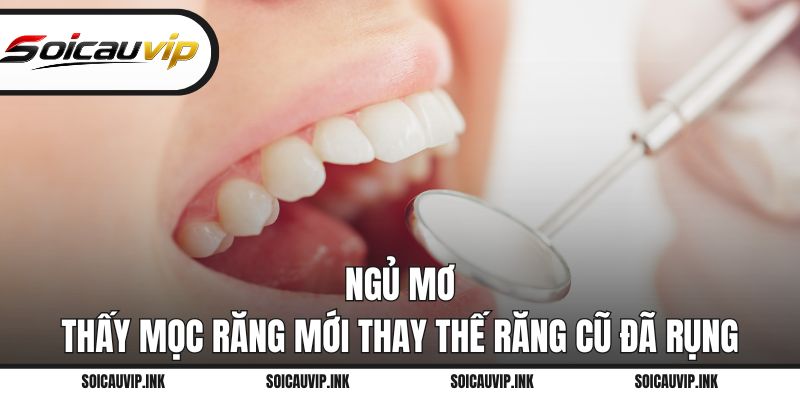 Ngủ mơ thấy mọc răng mới thay thế răng cũ đã rụng
